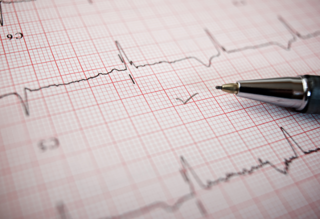 elettrocardiogramma screening