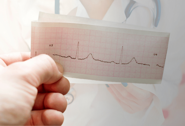 holter ecg